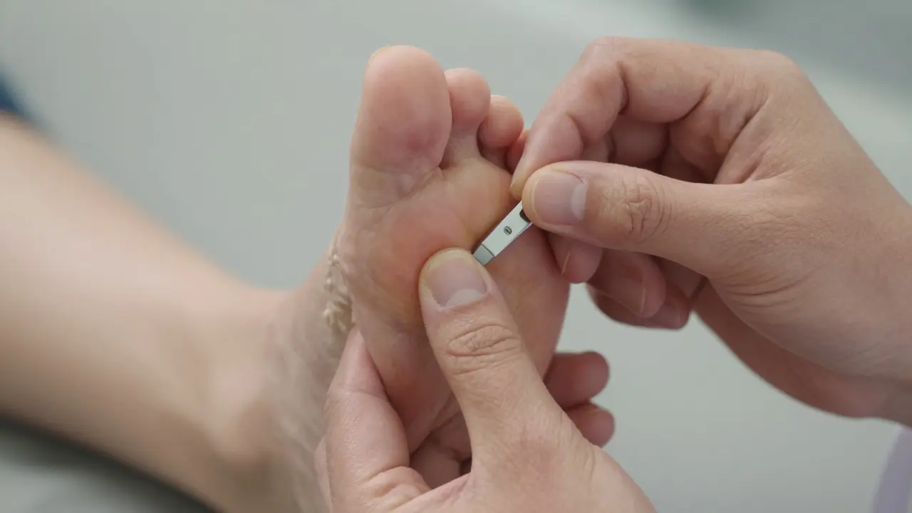 Lékař provádí Stemmerův test na palci pacienta pro diagnostiku lymfedému